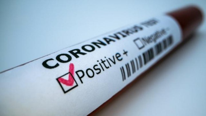 Begini Rasanya Terinfeksi Virus Corona: Pengakuan Pasien COVID-19 yang Sembuh