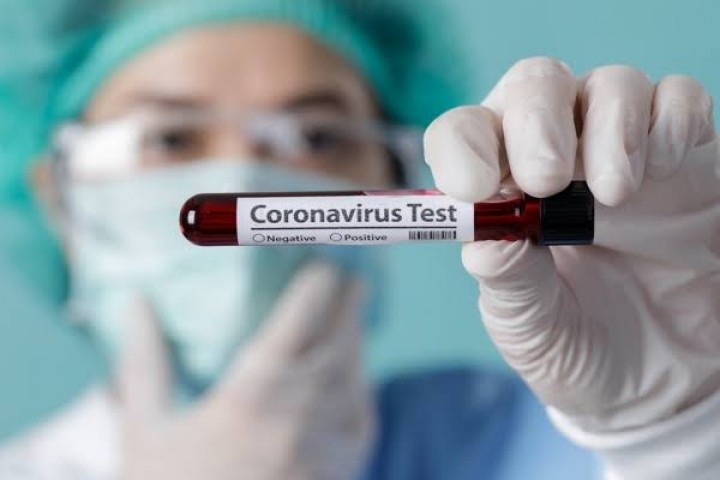 Bontang Terima 80 Rapid Test, Pemeriksaan Massal Tunggu Kiriman Tambahan