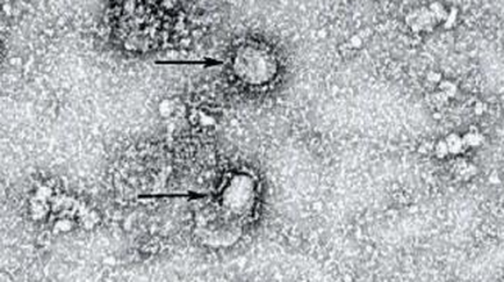 Studi Temukan Kelemahan Virus Corona
