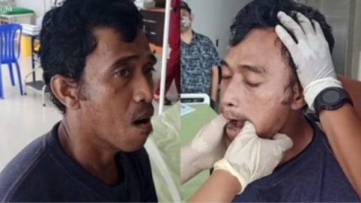 Jadi Pelajaran ! Rahang Pria Ini Bergeser karena Menguap Terlalu Lebar
