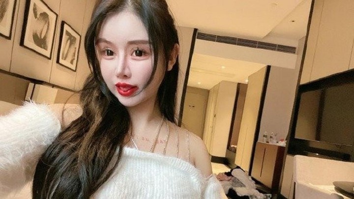 Gadis 16 Tahun Ini Jalani Operasi Plastik Hingga 100 Kali, Habiskan Biaya Rp 8 M