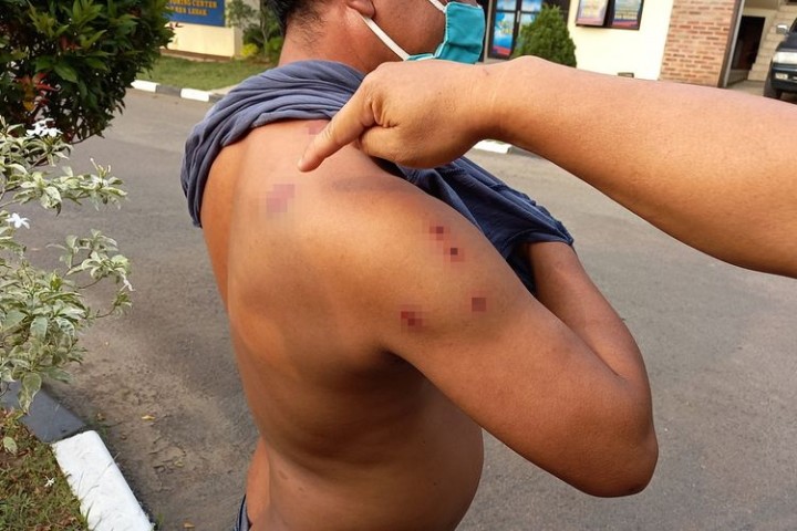 Sopir Taksi Duel Melawan 4 Begal, Kena 10 Tembakan