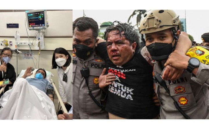 Ade Armando: Jangan Kalian Pikir Saya Takut, Saya Justru Akan Semakin Gila Setelah Ini!