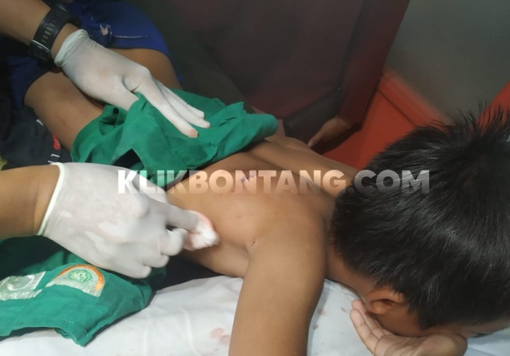 Bocah 10 Tahun di Selambai Diterkam Buaya