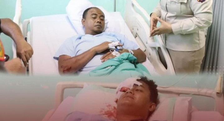 Pelaku Curanmor Nekat Tabrakkan Diri ke Polisi, 2 Petugas Dirawat di RS, Pelaku Kabur ke Hutan Bontang Lestari