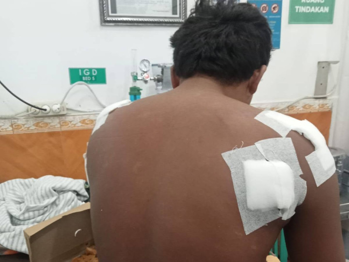 Cerita Korban Serangan Buaya di Pulau Kedindingan Bontang, Lepas Setelah Bilang Tak Pernah Sakiti Buaya